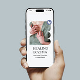 Svens Island New Zealand Calm the itch: A Holistic Guide to Eczema Relief E-book Eczema Cream